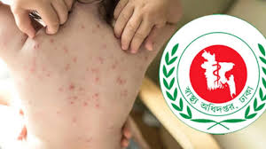 ২৪ ঘণ্টায় হাম ও উপসর্গে ১১ শিশুর মৃত্যু