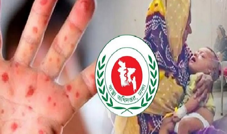 হাম উপসর্গে আরও চারজনের মৃত্যু