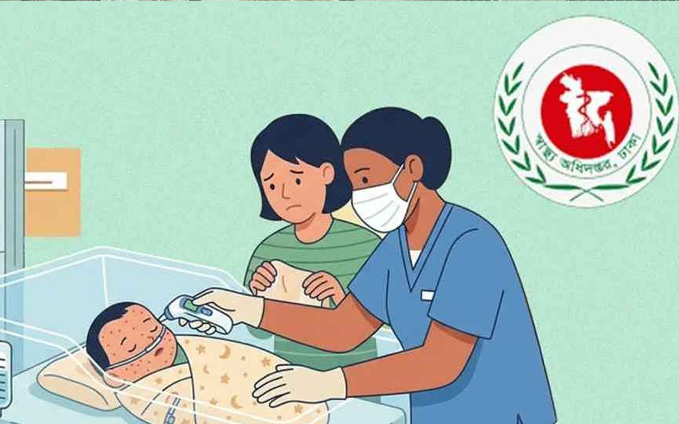 হাম উপসর্গে আরও ৫ জনের মৃত্যু