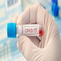 করোনা ভাইরাস : সোনামসজিদ ইমিগ্রেশনে মেডিকেল টিমের কাজ শুরু