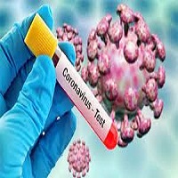  দেশে করোনায় আরো ৩ মৃত্যু, শনাক্ত ১৯