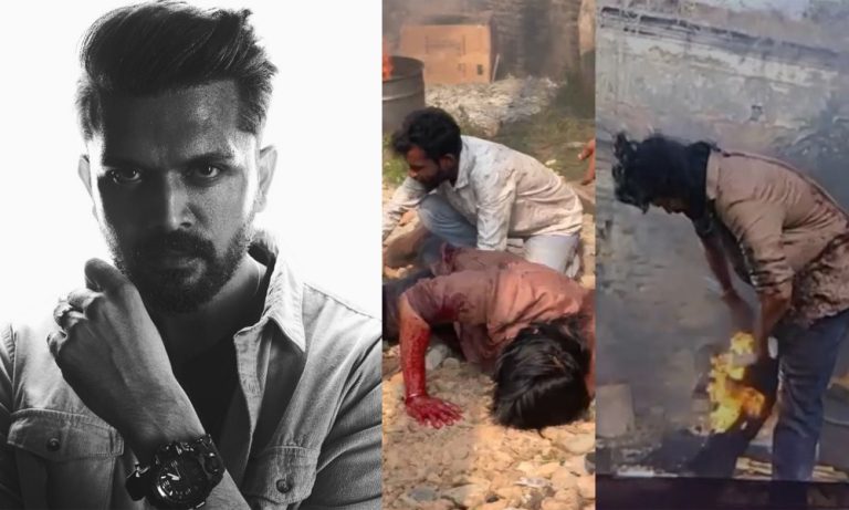 শুটিং সেটে অগ্নিদগ্ধ চিত্রনায়ক আরিফিন শুভ