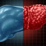 লিভার ড্যামেজের যে ৪ লক্ষণ অবহেলা করবেন না