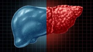 লিভার ড্যামেজের যে ৪ লক্ষণ অবহেলা করবেন না