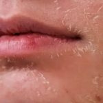 ত্বকের সমস্যা থেকে দূরে থাকতে যা করবেন শীতকালে