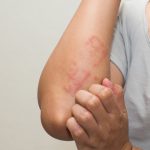 ঘরের ধুলাবালি থেকে অ্যালার্জি সতর্ক থাকবেন যেভাবে