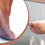 এখনই শীতে হাত-পা ফাটা থেকে মুক্তি পেতে ব্যবস্থা নিন