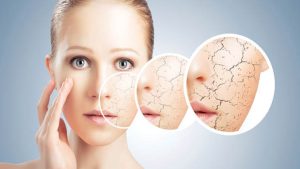 ত্বকে বয়সের ছাপ, পর্যাপ্ত প্রোটিন খাচ্ছেন তো?