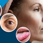 শরীরে ভিটামিনের অভাব? বুঝবেন যেভাবে