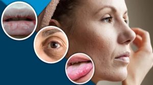 শরীরে ভিটামিনের অভাব? বুঝবেন যেভাবে